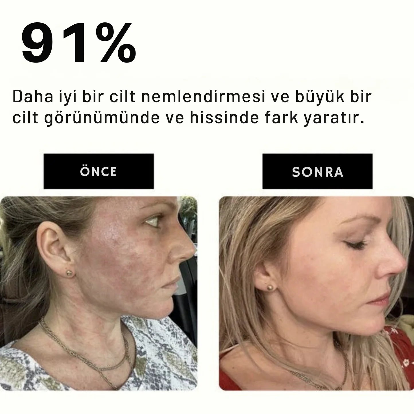 WaterDoom™ Filtreli Duş Başlığı