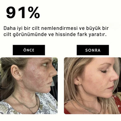 WaterDoom™ Filtreli Duş Başlığı